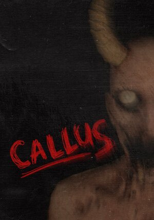 Мозоль / Callus